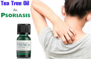 Tea Tree Oil For Psoriasis