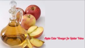Apple Cider Vinegar for Spider Veins