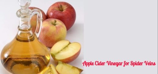 Apple Cider Vinegar for Spider Veins