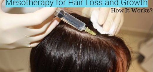 Mesotherapy for Hair Loss